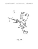 DEVICE AND METHOD FOR REGENERATIVE THERAPY BY HIGH INTENSITY LASER THERAPY diagram and image