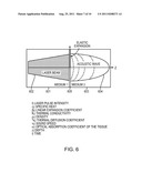 DEVICE AND METHOD FOR REGENERATIVE THERAPY BY HIGH INTENSITY LASER THERAPY diagram and image