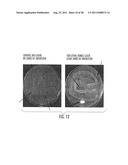 LOW ASPECT RATIO DIFFUSING FIBER TIP diagram and image