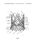 STENT FOR THE POSITIONING AND ANCHORING OF A VALVULAR PROSTHESIS IN AN     IMPLANTATION SITE IN THE HEART OF A PATIENT diagram and image