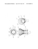 Catheter-Based Heart Valve Therapy System with Sizing Balloon diagram and image