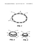 IMPLANTABLE DEVICES FOR CONTROLLING THE SIZE AND SHAPE OF AN ANATOMICAL     STRUCTURE OR LUMEN diagram and image