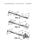 IMPLANTABLE DEVICES FOR CONTROLLING THE SIZE AND SHAPE OF AN ANATOMICAL     STRUCTURE OR LUMEN diagram and image