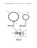 IMPLANTABLE DEVICES FOR CONTROLLING THE SIZE AND SHAPE OF AN ANATOMICAL     STRUCTURE OR LUMEN diagram and image