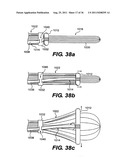 IMPLANTABLE DEVICES FOR CONTROLLING THE SIZE AND SHAPE OF AN ANATOMICAL     STRUCTURE OR LUMEN diagram and image