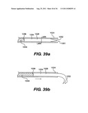 IMPLANTABLE DEVICES FOR CONTROLLING THE SIZE AND SHAPE OF AN ANATOMICAL     STRUCTURE OR LUMEN diagram and image