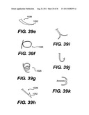 IMPLANTABLE DEVICES FOR CONTROLLING THE SIZE AND SHAPE OF AN ANATOMICAL     STRUCTURE OR LUMEN diagram and image