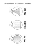 IMPLANTABLE DEVICES FOR CONTROLLING THE SIZE AND SHAPE OF AN ANATOMICAL     STRUCTURE OR LUMEN diagram and image