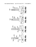 IMPLANTABLE DEVICES FOR CONTROLLING THE SIZE AND SHAPE OF AN ANATOMICAL     STRUCTURE OR LUMEN diagram and image