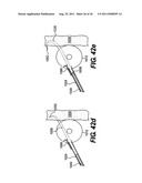 IMPLANTABLE DEVICES FOR CONTROLLING THE SIZE AND SHAPE OF AN ANATOMICAL     STRUCTURE OR LUMEN diagram and image