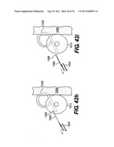 IMPLANTABLE DEVICES FOR CONTROLLING THE SIZE AND SHAPE OF AN ANATOMICAL     STRUCTURE OR LUMEN diagram and image