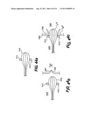 IMPLANTABLE DEVICES FOR CONTROLLING THE SIZE AND SHAPE OF AN ANATOMICAL     STRUCTURE OR LUMEN diagram and image