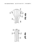 IMPLANTABLE DEVICES FOR CONTROLLING THE SIZE AND SHAPE OF AN ANATOMICAL     STRUCTURE OR LUMEN diagram and image