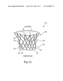 Mitral Prosthesis and Methods for Implantation diagram and image