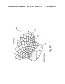 Mitral Prosthesis and Methods for Implantation diagram and image