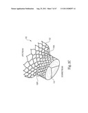 Mitral Prosthesis and Methods for Implantation diagram and image