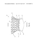 Mitral Prosthesis and Methods for Implantation diagram and image