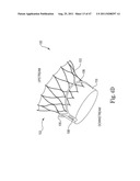 Mitral Prosthesis and Methods for Implantation diagram and image