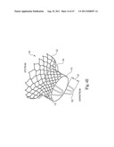 Mitral Prosthesis and Methods for Implantation diagram and image