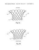 Mitral Prosthesis and Methods for Implantation diagram and image