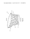 Mitral Prosthesis and Methods for Implantation diagram and image