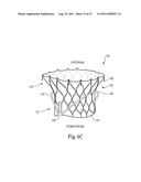 Mitral Prosthesis and Methods for Implantation diagram and image