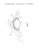 Mitral Prosthesis and Methods for Implantation diagram and image