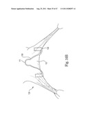 Mitral Prosthesis and Methods for Implantation diagram and image