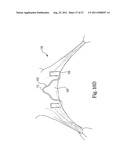 Mitral Prosthesis and Methods for Implantation diagram and image