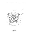 Mitral Prosthesis and Methods for Implantation diagram and image