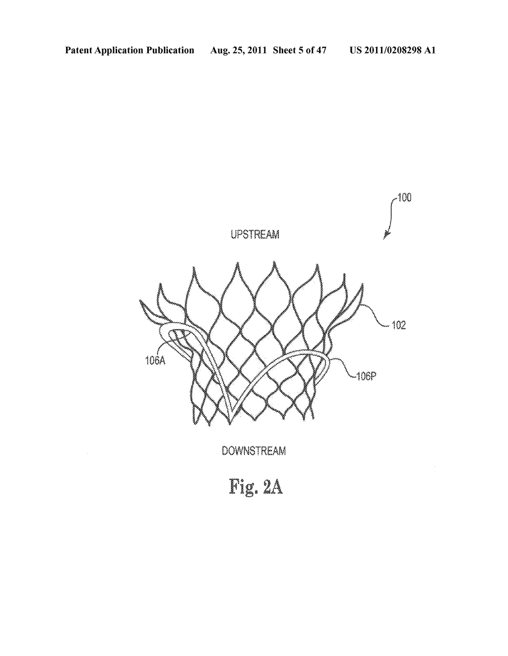 Mitral Prosthesis and Methods for Implantation - diagram, schematic, and image 06