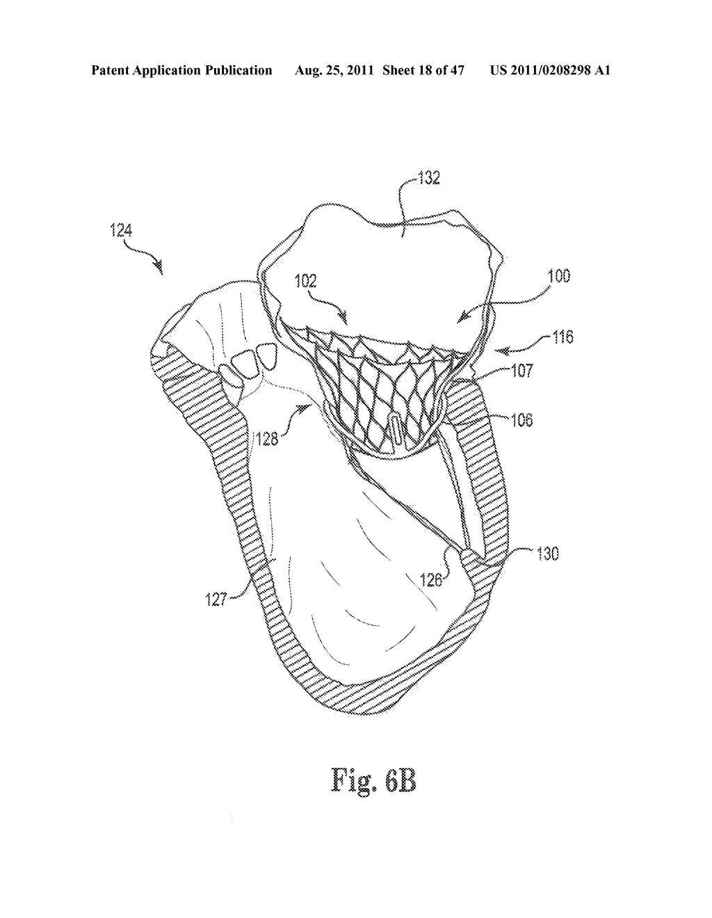 Mitral Prosthesis and Methods for Implantation - diagram, schematic, and image 19