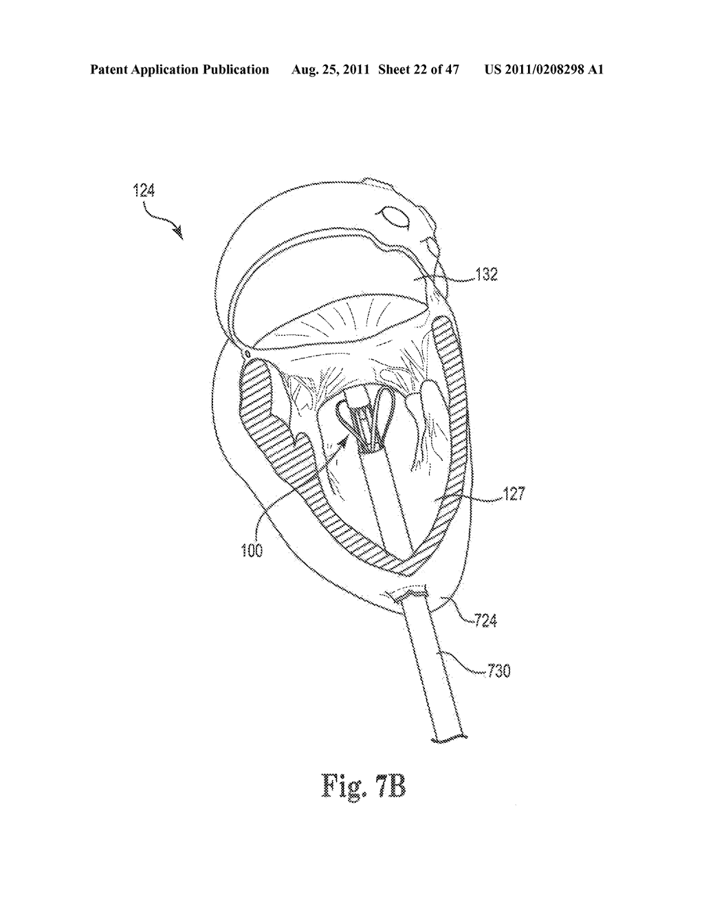 Mitral Prosthesis and Methods for Implantation - diagram, schematic, and image 23