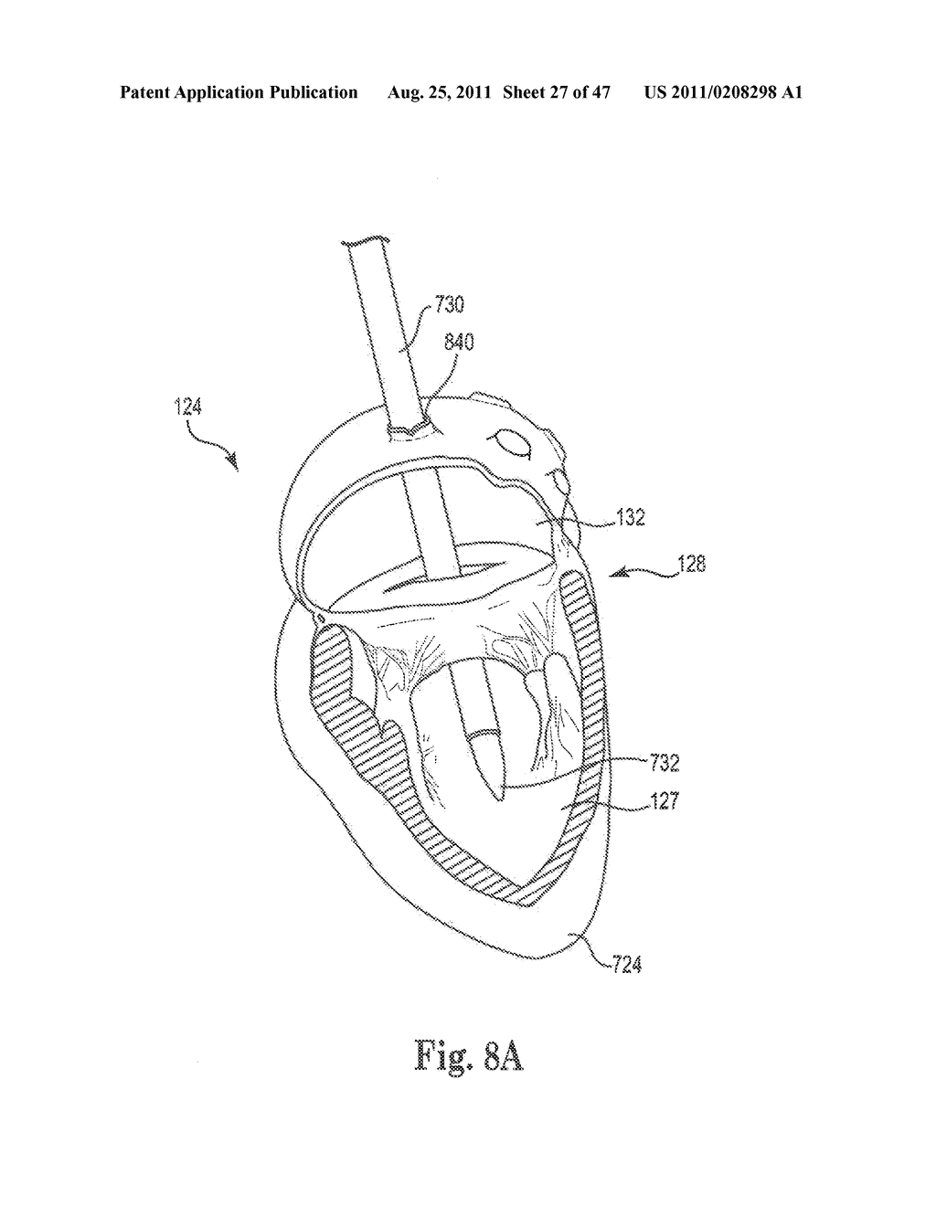 Mitral Prosthesis and Methods for Implantation - diagram, schematic, and image 28