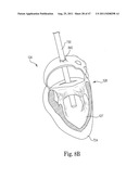 Mitral Prosthesis and Methods for Implantation diagram and image