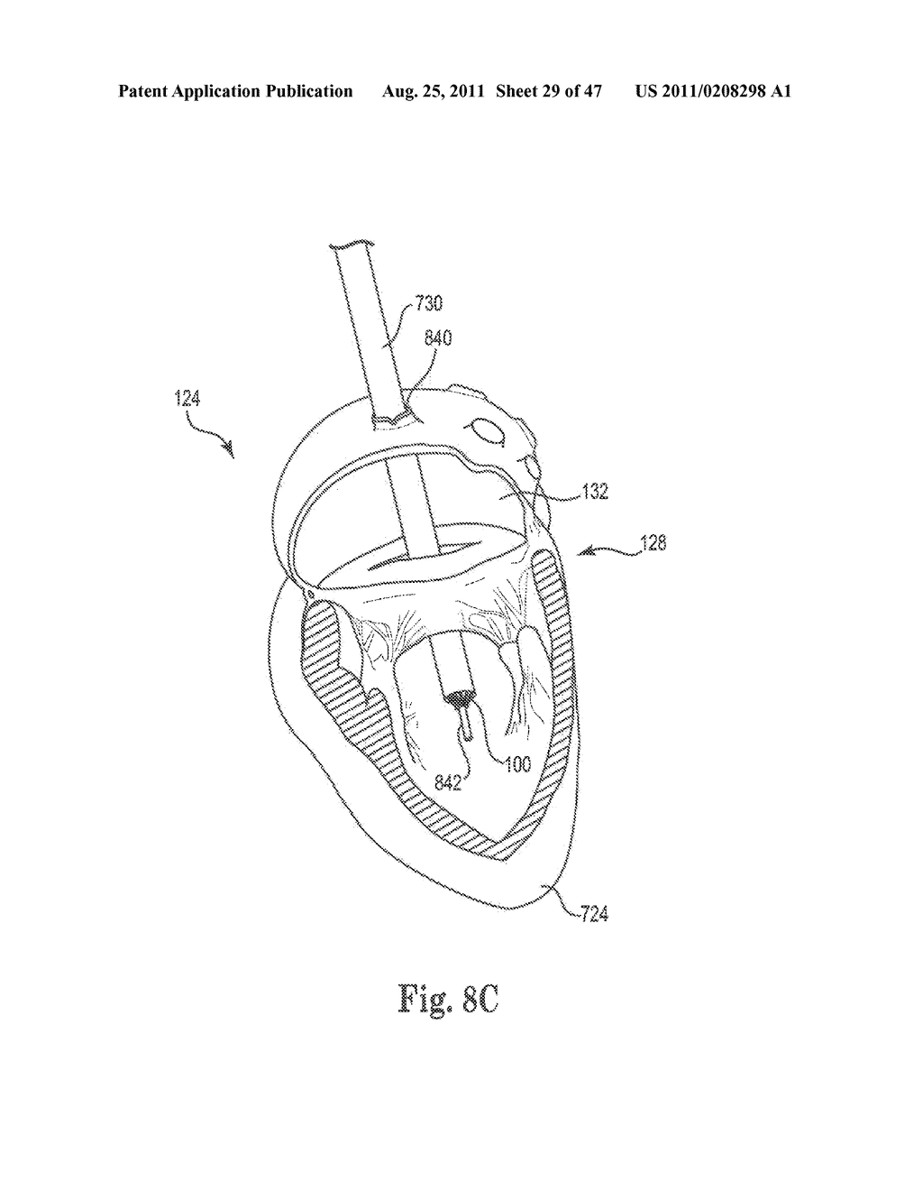 Mitral Prosthesis and Methods for Implantation - diagram, schematic, and image 30