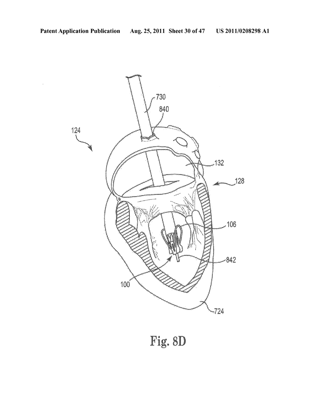 Mitral Prosthesis and Methods for Implantation - diagram, schematic, and image 31