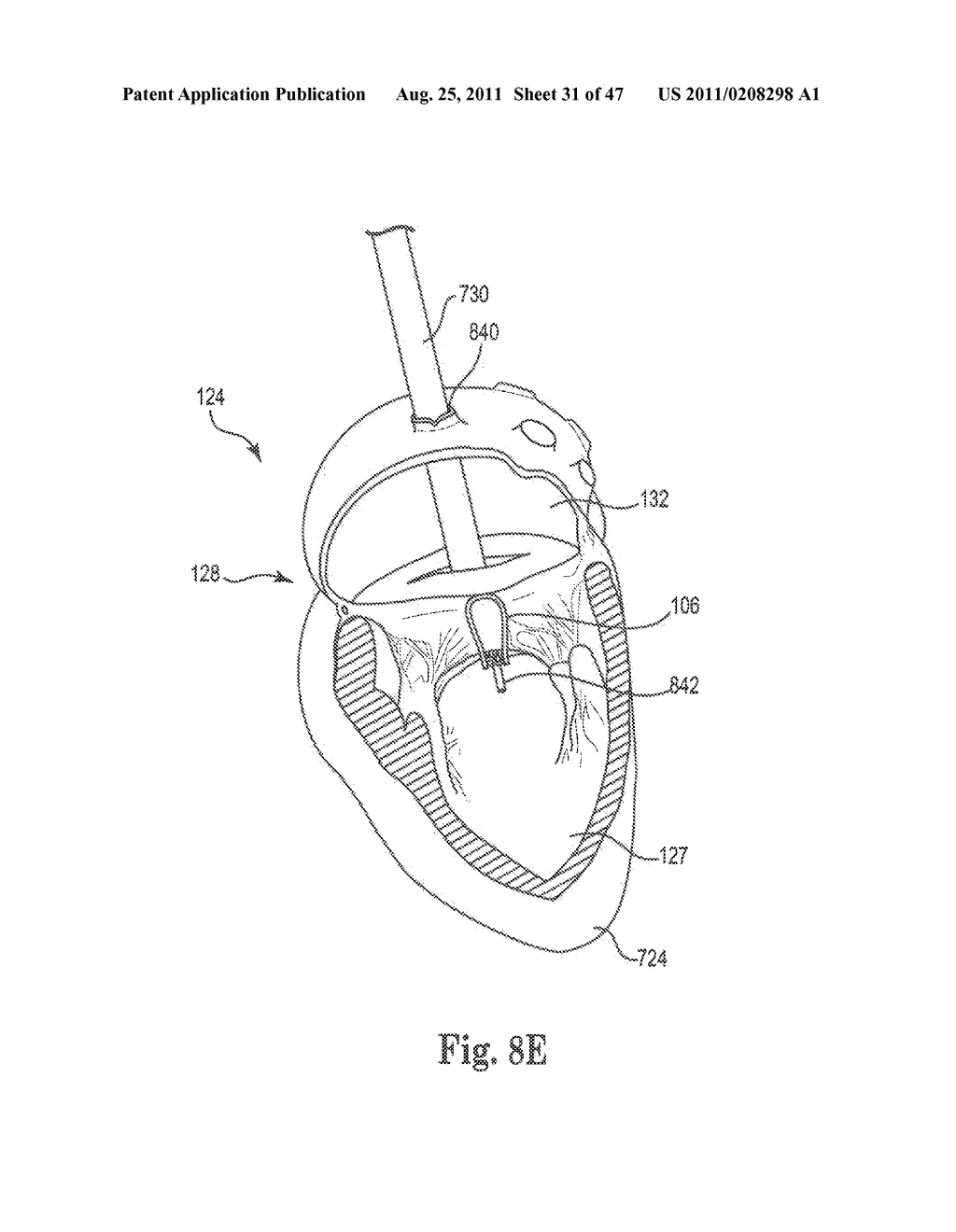 Mitral Prosthesis and Methods for Implantation - diagram, schematic, and image 32