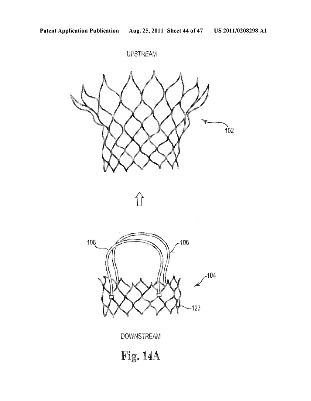 Mitral Prosthesis and Methods for Implantation - diagram, schematic, and image 45