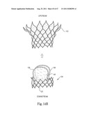 Mitral Prosthesis and Methods for Implantation diagram and image