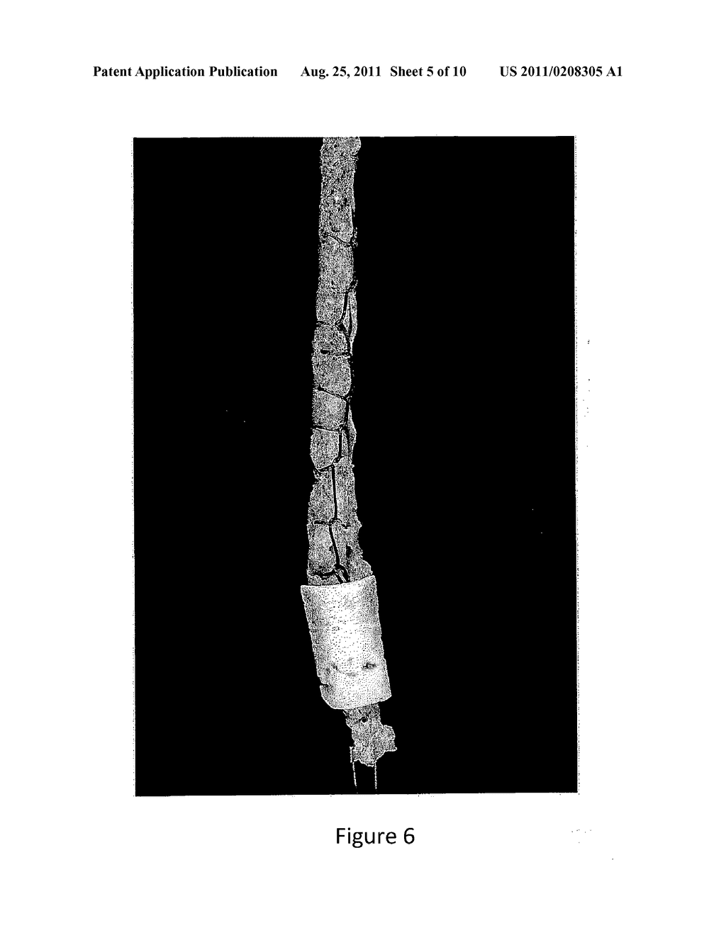 COMPOSITE BONE GRAFTS, PARTICULATE BONE-CALCIUM SULFATE CONSTRUCTS, AND     METHODS OF TREATING JOINT INJURIES - diagram, schematic, and image 06