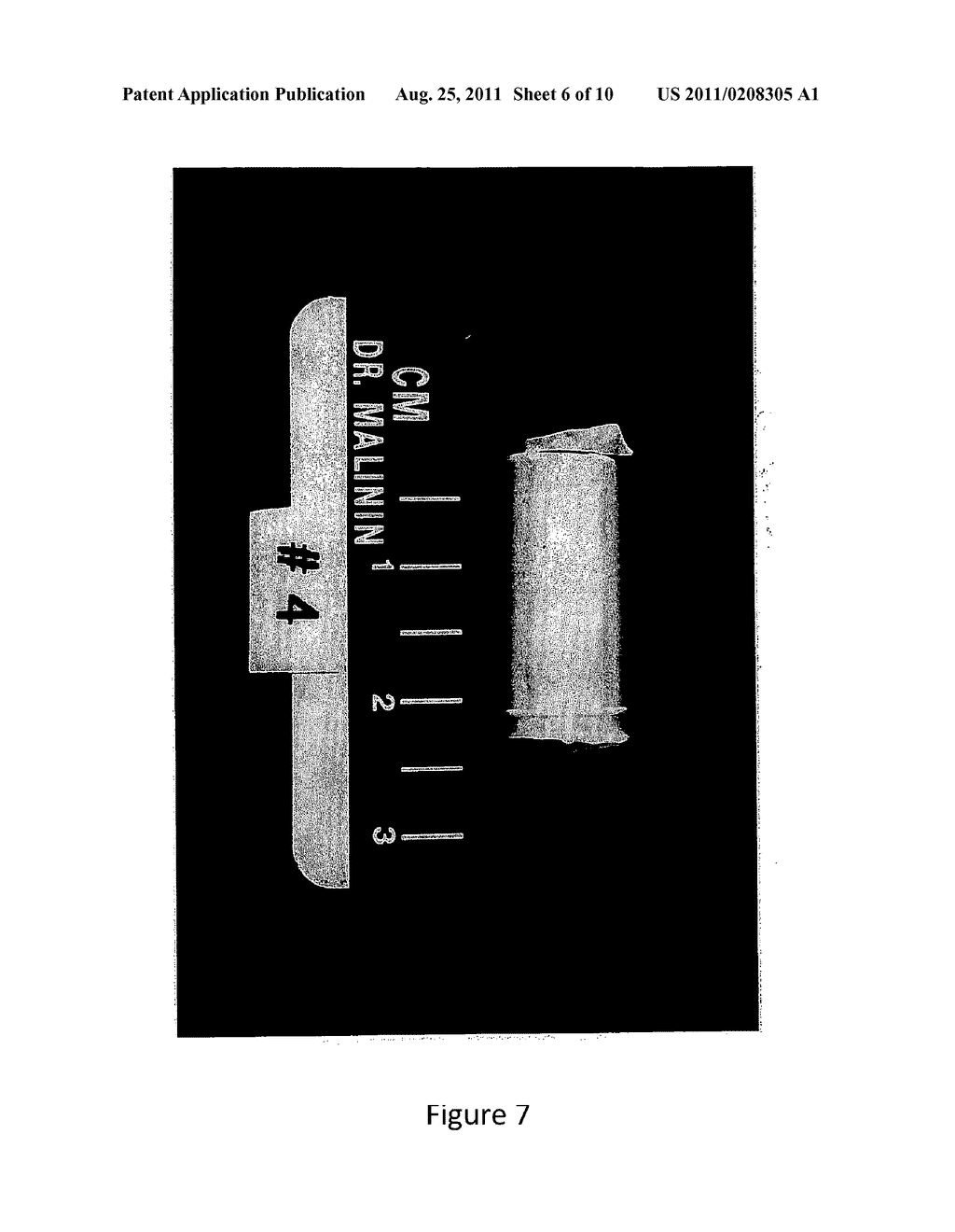 COMPOSITE BONE GRAFTS, PARTICULATE BONE-CALCIUM SULFATE CONSTRUCTS, AND     METHODS OF TREATING JOINT INJURIES - diagram, schematic, and image 07