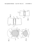 SPINAL FUSION IMPLANT WITH BONE SCREWS AND A BONE SCREW LOCK diagram and image