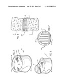 SPINAL FUSION IMPLANT WITH BONE SCREWS AND A BONE SCREW LOCK diagram and image