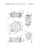 SPINAL FUSION IMPLANT WITH BONE SCREWS AND A BONE SCREW LOCK diagram and image