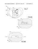 LATENT MOBILE BEARING FOR PROSTHETIC DEVICE diagram and image