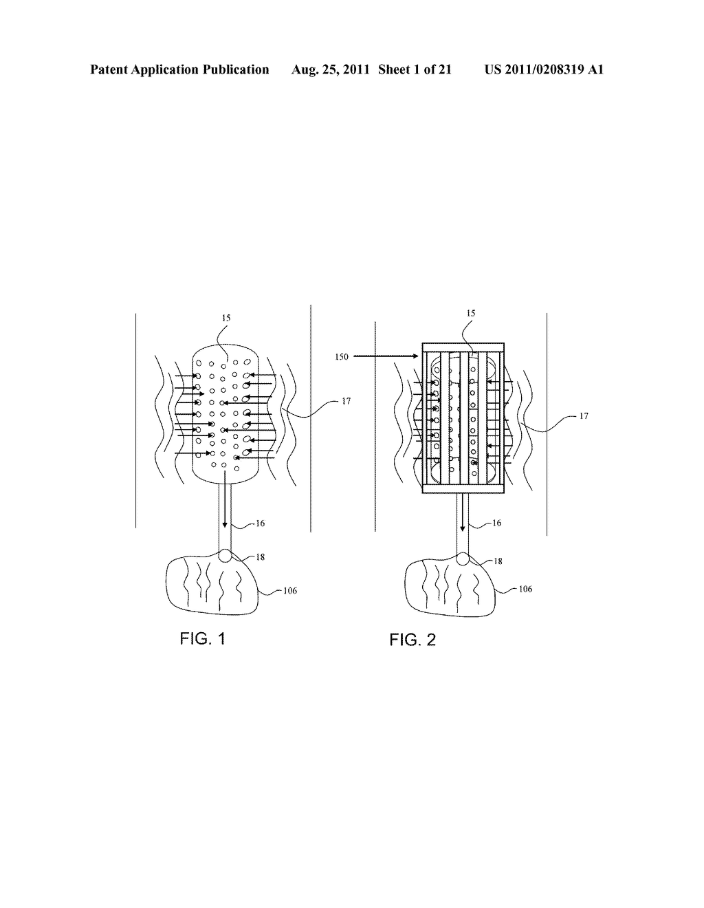 BLOOD FILTERING DEVICE AND METHOD - diagram, schematic, and image 02