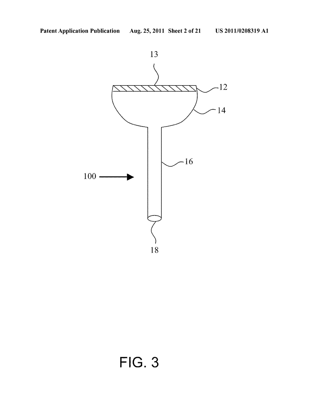 BLOOD FILTERING DEVICE AND METHOD - diagram, schematic, and image 03