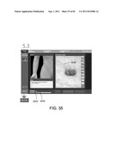 Showing Skin Lesion Information diagram and image