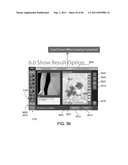 Showing Skin Lesion Information diagram and image